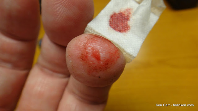 "I got blisters on my fingers"-Ringo